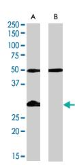 Anti-IGFBP3 Goat Polyclonal Antibody