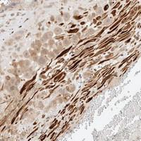 Anti-FAT1 Rabbit Polyclonal Antibody