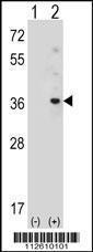 Anti-ATG10 Rabbit Polyclonal Antibody