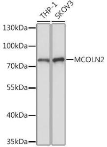 Anti-MCOLN2 Rabbit Polyclonal Antibody