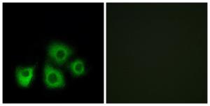 Immunofluorescence analysis of MCF7 cells using Anti-OR5M1 + OR5M10 Antibody. The right hand panel represents a negative control, where the antibody was pre-incubated with the immunising peptide.