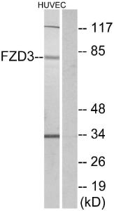 Western blot analysis of lysates from HUVEC cells using Anti-FZD3 Antibody. The right hand lane represents a negative control, where the antibody is blocked by the immunising peptide.