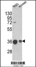 Anti-MDH2 Rabbit Polyclonal Antibody