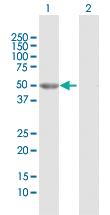 Anti-GALK2 Rabbit Polyclonal Antibody