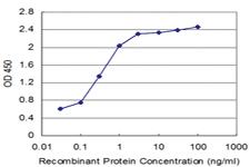 Anti-SYNE2 Mouse Monoclonal Antibody [clone: 5E5]