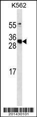 Anti-APCS Mouse Monoclonal Antibody [clone: 342CT9.4.7]