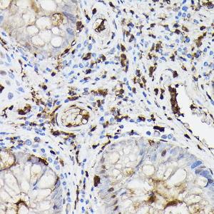 Anti-Gelsolin Rabbit Polyclonal Antibody