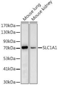 Western blot analysis of extracts of various cell lines, using Anti-EAAT3 Antibody (A9108) at 1:1,000 dilution. The secondary antibody was Goat Anti-Rabbit IgG H&L Antibody (HRP) at 1:10,000 dilution.