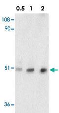 Anti-TTC5 Rabbit Polyclonal Antibody