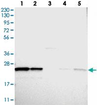 Anti-PSMB1 Rabbit Polyclonal Antibody