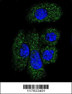 Anti-SERPING1 Rabbit Polyclonal Antibody