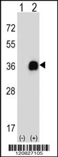 Anti-MDH2 Rabbit Polyclonal Antibody