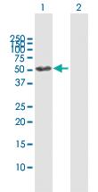 Anti-GALNS Rabbit Polyclonal Antibody