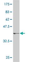 Anti-MGRN1 Mouse Monoclonal Antibody [clone: 3E1]