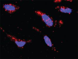 Anti-MAP3K7 + HSPA1L Antibody Pair