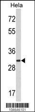 Anti-MARCKS Rabbit Polyclonal Antibody (AP (Alkaline Phosphatase))