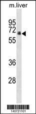 Anti-GGT1 Rabbit Polyclonal Antibody (AP (Alkaline Phosphatase))