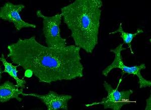 Wheat germ agglutin