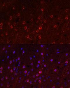 Immunofluorescence analysis of rat brain using Anti-EAAT3 Antibody (A9108) at a dilution of 1:100. DAPI was used to stain the cell nuclei (blue).