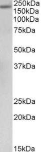 Anti-A2M Antibody (A85183) (0.5 µg/ml) staining of Human Albumin-depleted Serum lysate (35 µg protein in RIPA buffer). Primary incubation was 1 hour. Detected by chemiluminescence