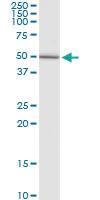 Anti-GALNS Rabbit Polyclonal Antibody