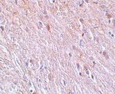 Anti-TTC5 Rabbit Polyclonal Antibody