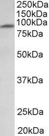 Anti-MFSD6 Antibody (A83516) (1µg/ml) staining of Human Heart lysate (35µg protein in RIPA buffer). Primary incubation was 1 hour. Detected by chemiluminescence.