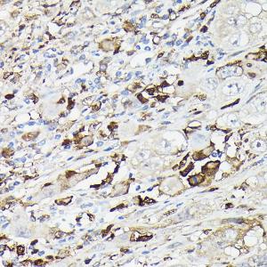 Anti-Gelsolin Rabbit Polyclonal Antibody