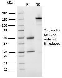 SDS-PAGE analysis of Anti-Prohibitin Antibody [PHB/3231] under non-reduced and reduced conditions; showing intact IgG and intact heavy and light chains, respectively. SDS-PAGE analysis confirms the integrity and purity of the antibody