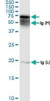 Anti-GALNS Rabbit Polyclonal Antibody