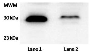 Anti-TTC33 Rabbit Polyclonal Antibody (Biotin)