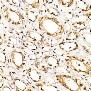 Immunohistochemistry analysis of paraffin-embedded human kidney using Anti-ERK1 + ERK2 Antibody [ARC0212] (A306245) at a dilution of 1:100 (40x lens). Perform high pressure antigen retrieval with 10 mM citrate buffer pH 6.0 before commencing with IHC staining protocol.