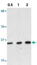 Anti-DEDD2 Rabbit Polyclonal Antibody