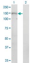 Anti-PNPLA6 Mouse Monoclonal Antibody [clone: 3D10]