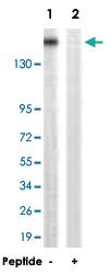 Anti-CASR Rabbit Polyclonal Antibody