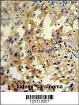 Anti-UPP2 Rabbit Polyclonal Antibody (HRP (Horseradish Peroxidase))