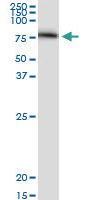 Anti-SERPING1 Mouse Monoclonal Antibody [clone: 3F4-1D9]