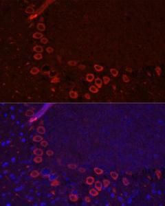 Immunofluorescence analysis of mouse brain using Anti-EAAT3 Antibody (A9108) at a dilution of 1:100. DAPI was used to stain the cell nuclei (blue).