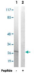 Anti-MRPL16 Rabbit Polyclonal Antibody