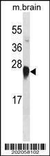 Anti-APOA1 Mouse Monoclonal Antibody (PE (Phycoerythrin)) [clone: 464CT10.4.4]