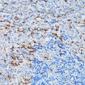 Anti-Gelsolin Rabbit Polyclonal Antibody