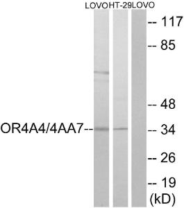 Western blot analysis of lysates from LOVO cells and HT29 cells using Anti-OR4A4 + OR4A47 Antibody. The right hand lane represents a negative control, where the Antibody is blocked by the immunising peptide