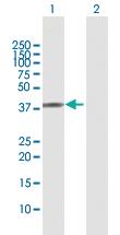 Anti-TWF2 Rabbit Polyclonal Antibody