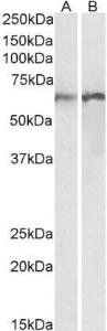 Anti-CALR Antibody (A85185) (0.01 µg/ml) staining of Human (A) and Rat (B) Lung lysates (35 µg protein in RIPA buffer). Primary incubation was 1 hour. Detected by chemiluminescence