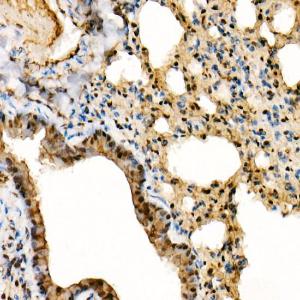 Immunohistochemistry analysis of paraffin-embedded mouse lung using Anti-ERK1 + ERK2 Antibody [ARC0212] (A306245) at a dilution of 1:100 (40x lens). Perform high pressure antigen retrieval with 10 mM citrate buffer pH 6.0 before commencing with IHC staining protocol.