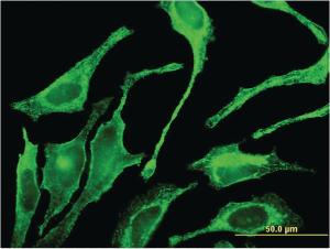 Anti-GALNT1 Mouse Monoclonal Antibody [clone: 3C10]