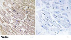 Anti-MRPL16 Rabbit Polyclonal Antibody