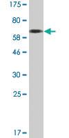 Anti-CEACAM1 Mouse Monoclonal Antibody [clone: 2F6]