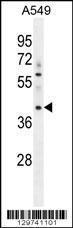 Anti-MYBPHL Rabbit Polyclonal Antibody (Biotin)