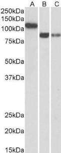 Anti-CDH13 Antibody (A83518) (0.3µg/ml) staining of Human Heart (A), Amygdala (B) and Hippocampus (C) lysates (35µg protein in RIPA buffer). Primary incubation was 1 hour. Detected by chemiluminescence.